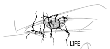 Life 02편